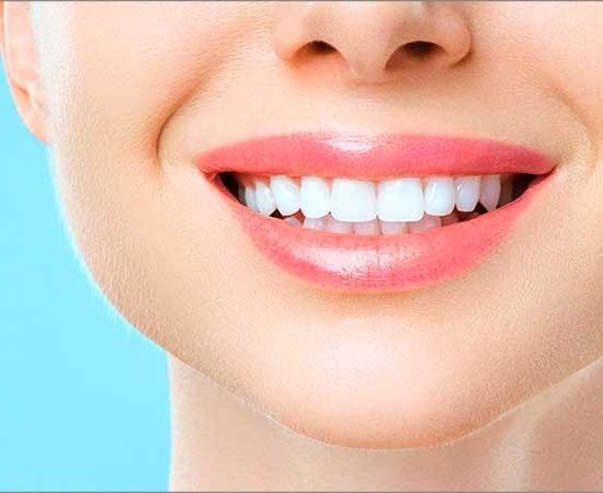 Best Smile Designing in Lingampally